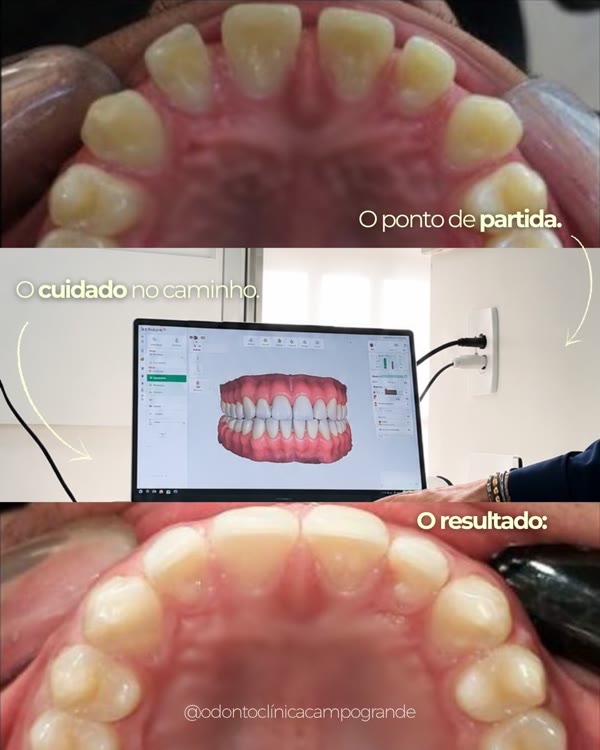 Ponto de partida, planejamento digital e resultado